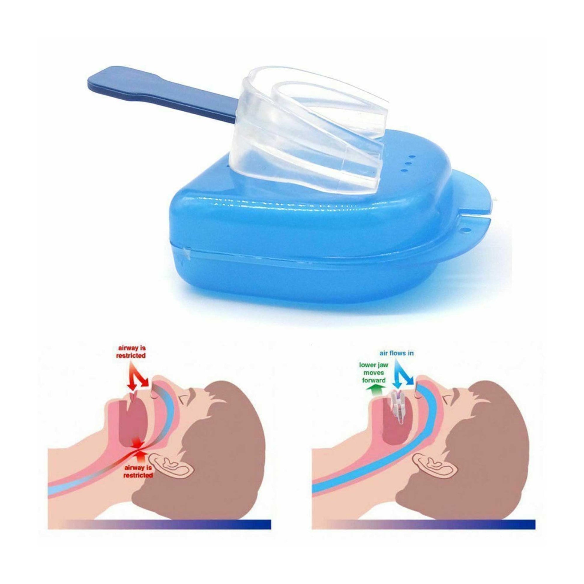 3x Anti Snoring Aid Mouth Guard - Adjustable Mouthguard Sleeping and Breathing-3